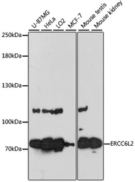 Anti-RAD26L antibody used in Western Blot (WB). GTX66172