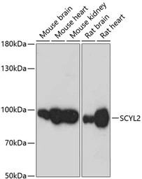 Anti-SCYL2 antibody used in Western Blot (WB). GTX66174