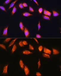 Anti-SCYL2 antibody used in Immunocytochemistry/ Immunofluorescence (ICC/IF). GTX66174