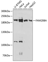 Anti-FAM208A antibody used in Western Blot (WB). GTX66177
