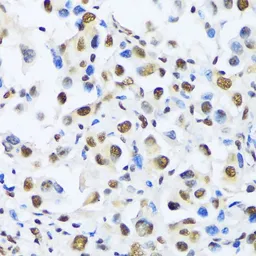 Anti-OTP antibody used in IHC (Paraffin sections) (IHC-P). GTX66178