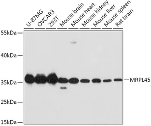 Anti-MRPL45 antibody used in Western Blot (WB). GTX66181