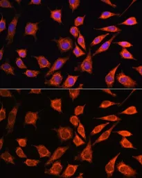 Anti-MRPL45 antibody used in Immunocytochemistry/ Immunofluorescence (ICC/IF). GTX66181