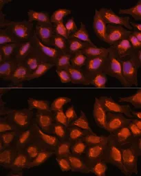 Anti-MRPL45 antibody used in Immunocytochemistry/ Immunofluorescence (ICC/IF). GTX66181