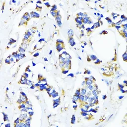 Anti-MRPL45 antibody used in IHC (Paraffin sections) (IHC-P). GTX66181