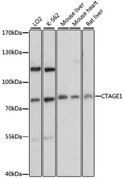 Anti-CTAGE1 antibody used in Western Blot (WB). GTX66185