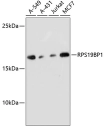 Anti-RPS19BP1 antibody used in Western Blot (WB). GTX66186