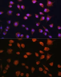 Anti-RPS19BP1 antibody used in Immunocytochemistry/ Immunofluorescence (ICC/IF). GTX66186