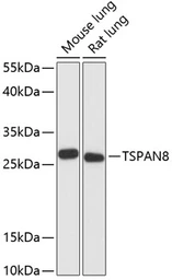 Anti-TM4SF3 / TSPAN8 antibody used in Western Blot (WB). GTX66188
