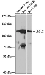 Anti-LLGL2 antibody used in Western Blot (WB). GTX66189