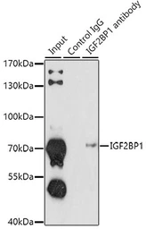 Anti-IGF2BP1 antibody used in Immunoprecipitation (IP). GTX66193