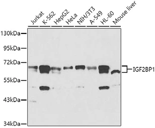 Anti-IGF2BP1 antibody used in Western Blot (WB). GTX66193