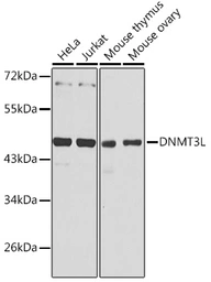 Anti-DNMT3L antibody used in Western Blot (WB). GTX66194