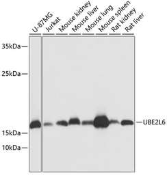 Anti-UBE2L6 antibody used in Western Blot (WB). GTX66195