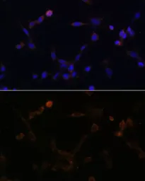 Anti-UBE2L6 antibody used in Immunocytochemistry/ Immunofluorescence (ICC/IF). GTX66195