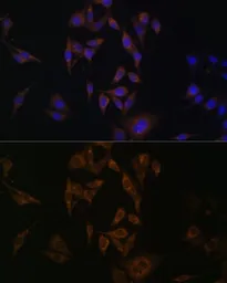 Anti-UBE2L6 antibody used in Immunocytochemistry/ Immunofluorescence (ICC/IF). GTX66195