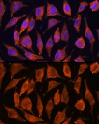 Anti-TNFAIP8L2 antibody used in Immunocytochemistry/ Immunofluorescence (ICC/IF). GTX66198