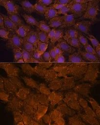 Anti-TNFAIP8L2 antibody used in Immunocytochemistry/ Immunofluorescence (ICC/IF). GTX66198