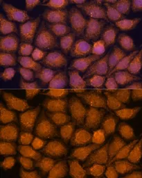 Anti-TNFAIP8L2 antibody used in Immunocytochemistry/ Immunofluorescence (ICC/IF). GTX66198