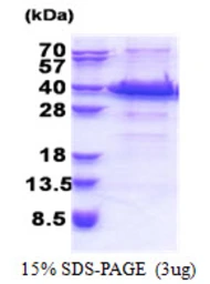 Human ACBD6 protein, His tag. GTX66202-pro
