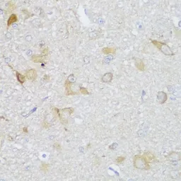 Anti-Edc3 antibody used in IHC (Paraffin sections) (IHC-P). GTX66203