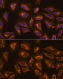 Anti-Lysyl-tRNA synthetase antibody used in Immunocytochemistry/ Immunofluorescence (ICC/IF). GTX66204