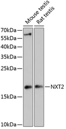 Anti-NXT2 antibody used in Western Blot (WB). GTX66213