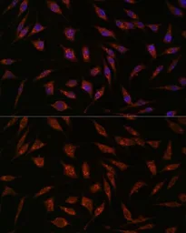 Anti-NXT2 antibody used in Immunocytochemistry/ Immunofluorescence (ICC/IF). GTX66213