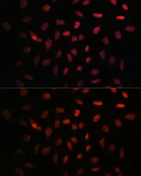 Anti-NXT2 antibody used in Immunocytochemistry/ Immunofluorescence (ICC/IF). GTX66213
