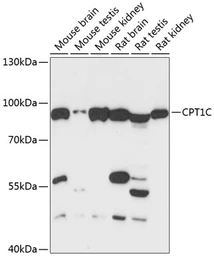 Anti-CPT1C antibody used in Western Blot (WB). GTX66217