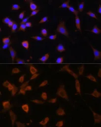 Anti-alpha Glucosidase II antibody used in Immunocytochemistry/ Immunofluorescence (ICC/IF). GTX66218