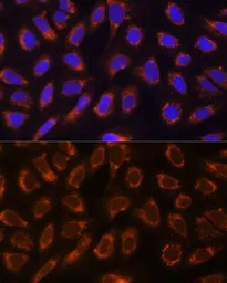 Anti-alpha Glucosidase II antibody used in Immunocytochemistry/ Immunofluorescence (ICC/IF). GTX66218