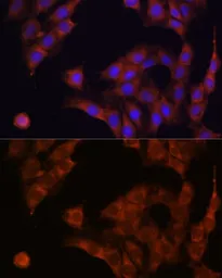 Anti-alpha Glucosidase II antibody used in Immunocytochemistry/ Immunofluorescence (ICC/IF). GTX66218