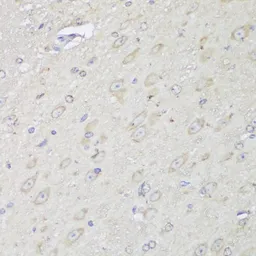 Anti-alpha Glucosidase II antibody used in IHC (Paraffin sections) (IHC-P). GTX66218