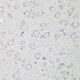 Anti-alpha Glucosidase II antibody used in IHC (Paraffin sections) (IHC-P). GTX66218