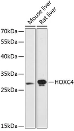 Anti-HOXC4 antibody used in Western Blot (WB). GTX66219