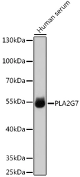 Anti-PLA2G7 antibody used in Western Blot (WB). GTX66220