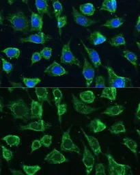 Anti-PTPN22 antibody used in Immunocytochemistry/ Immunofluorescence (ICC/IF). GTX66229