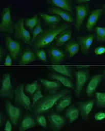 Anti-PTPN22 antibody used in Immunocytochemistry/ Immunofluorescence (ICC/IF). GTX66229