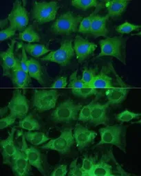 Anti-PTPN22 antibody used in Immunocytochemistry/ Immunofluorescence (ICC/IF). GTX66229