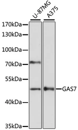Anti-GAS7 antibody used in Western Blot (WB). GTX66234