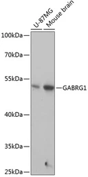 Anti-GABA A Receptor gamma 1 antibody used in Western Blot (WB). GTX66238