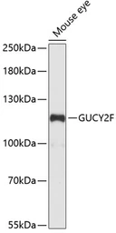 Anti-GUCY2F antibody used in Western Blot (WB). GTX66239