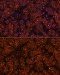 Anti-HMGCS2 antibody used in IHC (Paraffin sections) (IHC-P). GTX66240
