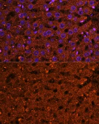 Anti-HMGCS2 antibody used in IHC (Paraffin sections) (IHC-P). GTX66240