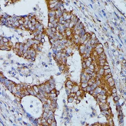 Anti-HMGCS2 antibody used in IHC (Paraffin sections) (IHC-P). GTX66240