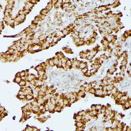 Anti-HMGCS2 antibody used in IHC (Paraffin sections) (IHC-P). GTX66240