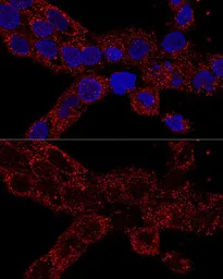 Anti-RPL21 antibody used in Immunocytochemistry/ Immunofluorescence (ICC/IF). GTX66241