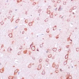 Anti-RPL21 antibody used in IHC (Paraffin sections) (IHC-P). GTX66241