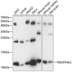 Anti-NDUFA4L2 antibody used in Western Blot (WB). GTX66244